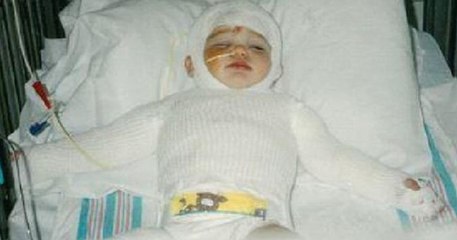 Beba koja je preživjela nemoguće