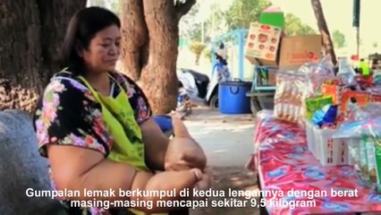 EDAN!! LIHAT Wanita Ini Miliki KEANEHAN MISTERIUS Mengundang PERHATIAN WARGA SEDUNIA