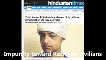 Indian Army crimes against civilians of Kashmir  Pellet GUN victim Kashmiri civilians!