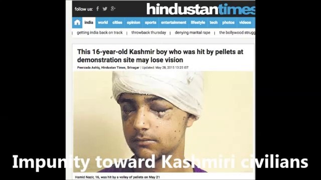 Indian Army crimes against civilians of Kashmir Pellet GUN victim Kashmiri civilians!