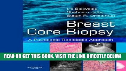 [FREE] EBOOK Breast Core Biopsy: A Pathologic-Radiologic Approach, 1e ONLINE COLLECTION