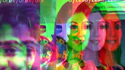 bollywood clebs are change after cosmetic surgary