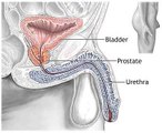 Which Dietary Factors are Important in Prostate Enlargement?