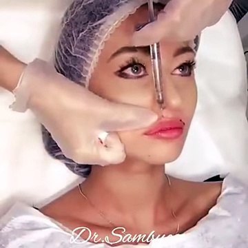 Painful Procedure of Lips Surgery For Getting Beautiful Lips - Sehat - YouTube