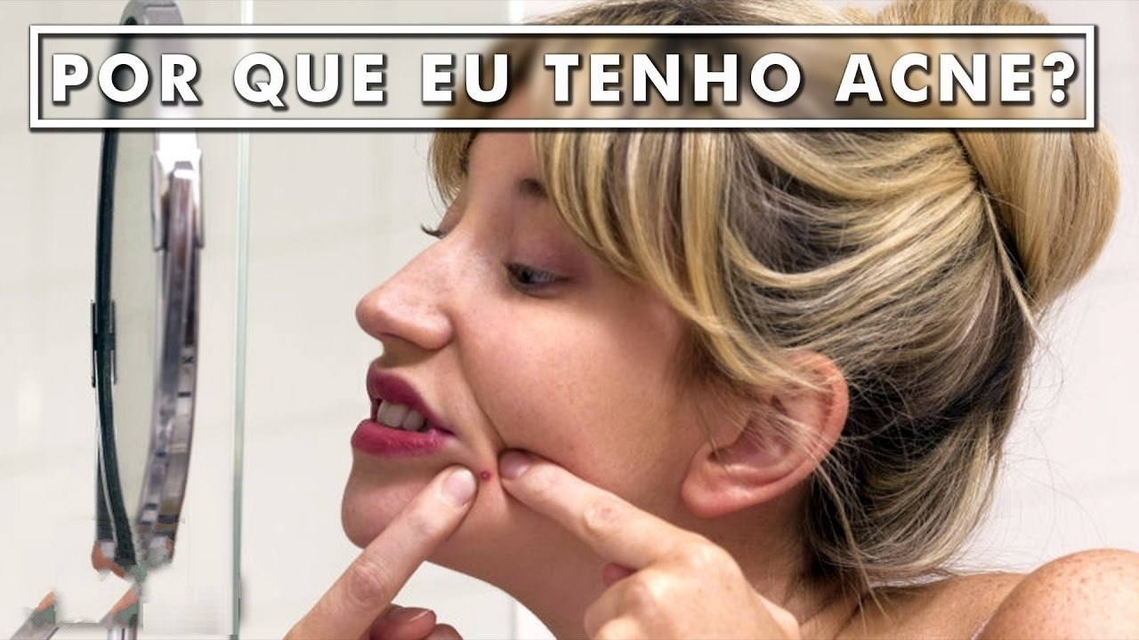 Por quê algumas Pessoas têm Acne e outras não