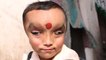 Boy With Mystery Condition Is Worshipped As A God: BORN DIFFERENT