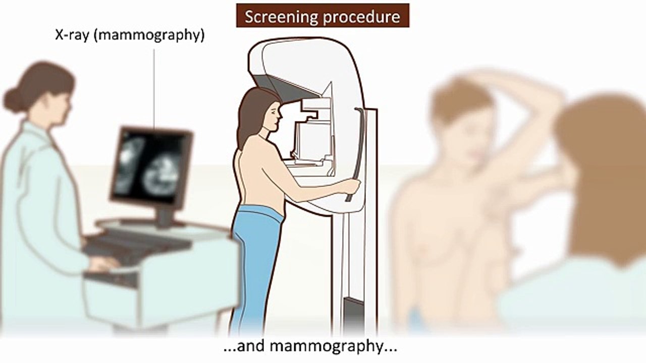 Breast cancer - Symptoms and treatment