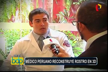 Hazaña de médico peruano: innovador procedimiento para prótesis en beneficio de pacientes