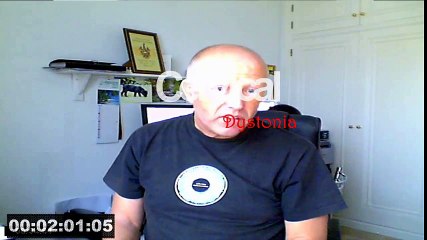 Dystonia Convulsions - 2min countdown