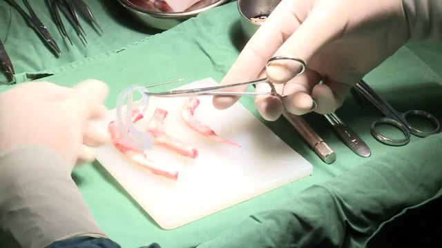 Chinese man grows ear on arm in medical breakthrough