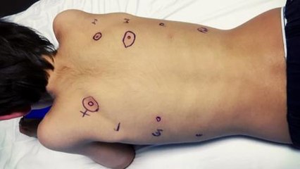 Techknow - Cracking the Peanut Allergy promo