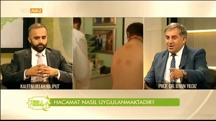 Hacamat Nedir? Hacamatı Bir Hekim Mi Uygulamalı? - Tıbb-ı Nebevi - TRT Avaz
