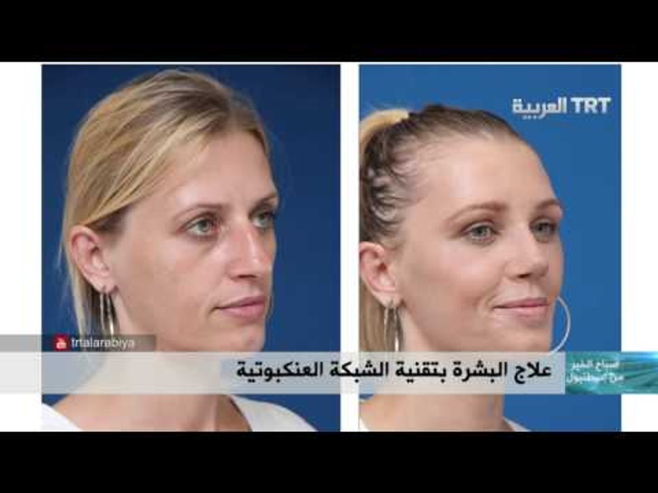 برنامج صباح الخير من اسطنبول حلقة 02.12.2015