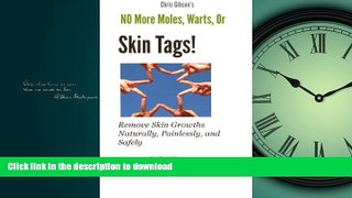 READ  No More Moles Warts or Skin Tags!  GET PDF