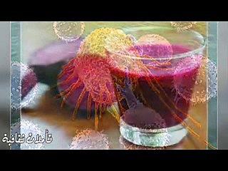 Traiter le cancer par la diète (copiée )( غلاج السرطان بواسطة النظام الغدائي (منقول