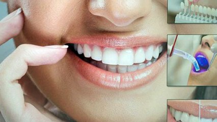 Emergency Dentist Near Me in Pinecrest, FL