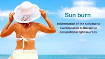 Sunburn Causes, Symptoms, and Treatment