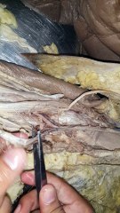 upper limb dissection PGIMS Rohtak