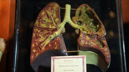 متحف وحانة في نيويورك يجذب محبي التشريح واجواء الموت