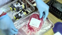 Umbilical Cord Blood Stem Cell Banking - Cryoviva India
