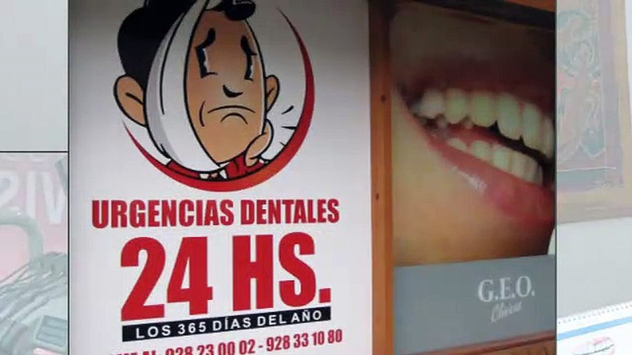 implantes dentales en las palmas