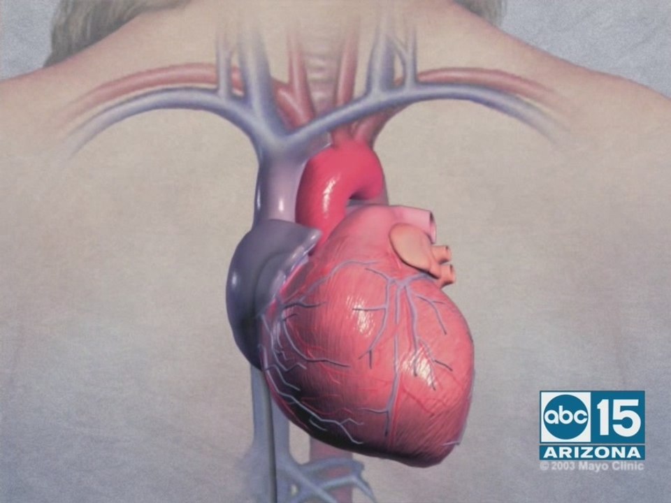 Mayo Clinic shares new treatment options for atrial fibrillation