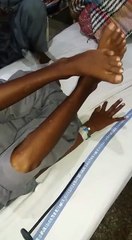 Wilson's Disease: Signs and Symptoms