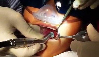 Biolase Laser Dentisty - Phan-tastic Smiles