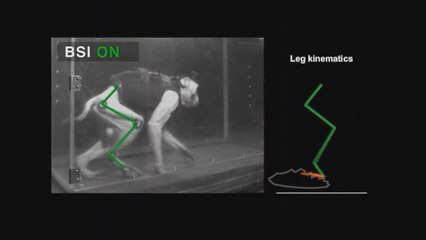 Megmozdult a béna láb az agy-gerinc interfésznek köszönhetően