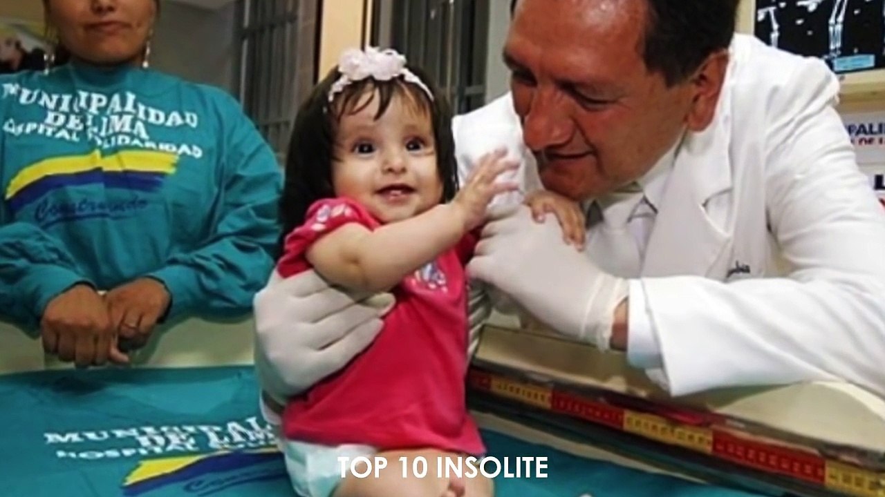 10 Personnes avec des MUTATIONS GENETIQUES EXTRAORDINAIRE ! Incroyables Mutations Très RARE