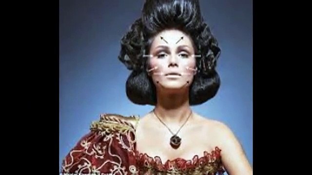 Leading Tear Trough London Procedure With Dr Nirdosh