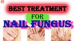 Best Treatment of Nail Fungas | Vinegar As a Toenail Fungus Treatment | Fast Cure For Toenail Fungus