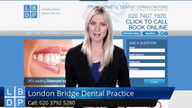 Dentist In SE1 Exceptional Five Star Review by Caroline M