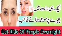 Remedy To Get Ride Of Pimple OverNight| Ek Hi Raat Mein Pimple Khatam
