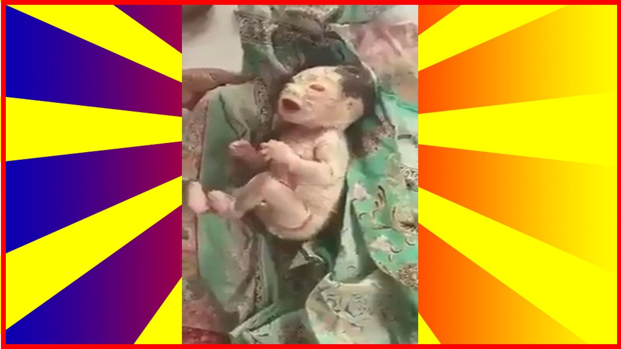 Unusual unique baby