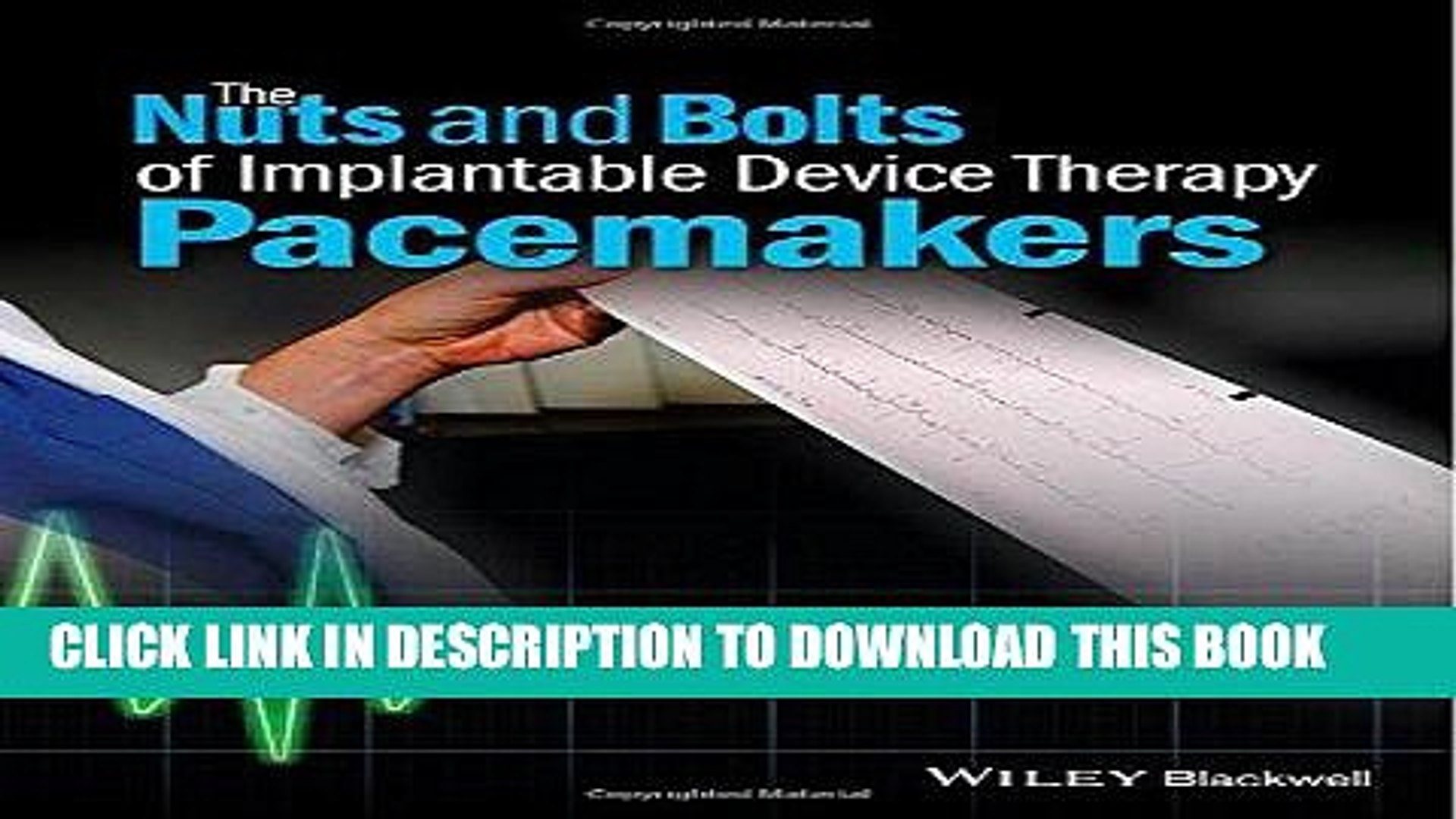 Read Now The Nuts And Bolts Of Implantable Device Therapy Pacemakers The Nuts And Bolts Series Video Dailymotion