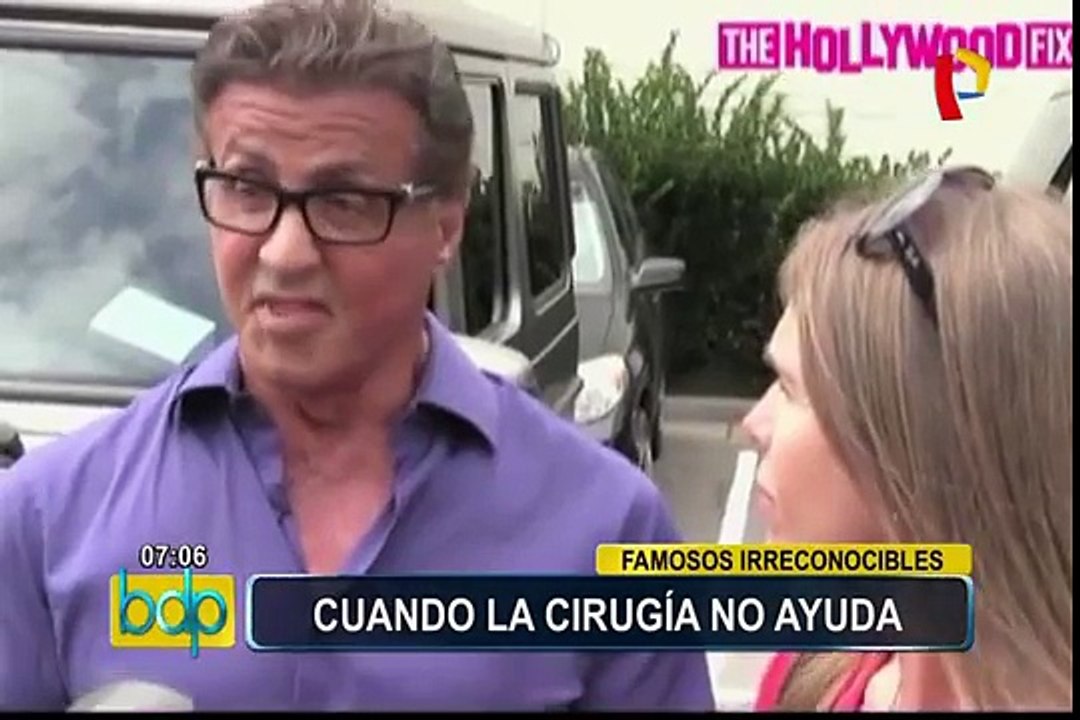 VIDEO: el antes y después de artistas que se sometieron a cirugías