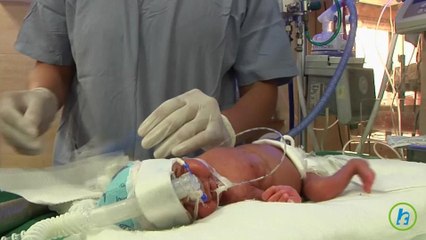 Research on Premature Babies