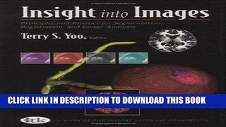 Read Now Insight into Images: Principles and Practice for Segmentation, Registration, and Image