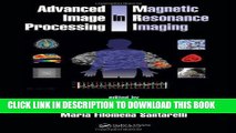 Ebook Advanced Image Processing in Magnetic Resonance Imaging (Signal Processing and