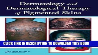 Ebook Dermatology and Dermatological Therapy of Pigmented Skins Free Read