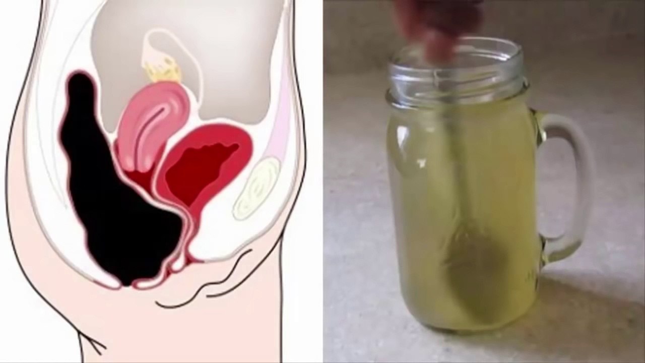 This Simple Drink Removes Pounds of Toxins from Your Colon