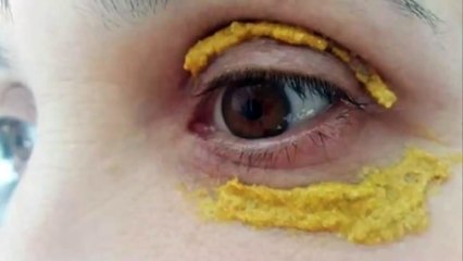 She Put Turmeric Around The Eyes And 5 Days Later, Something Incredible Happened!