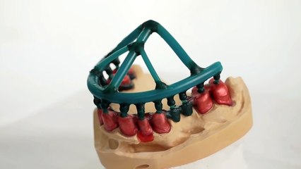 Качественное протезирование зубов