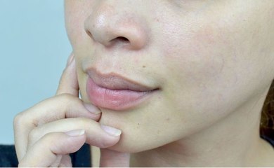 How to Make Your Lips Pink Naturally