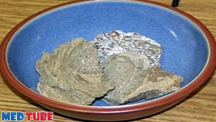 صياد عُماني فقير قادته “رائحة كريهة” في البحر إلى ثروة بالملايين!!