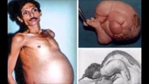 بارداری مردی که دنیا را مبهوت کرد   عکس