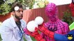 Pink Spidergirl Loses Her Eyes vs Doctor w/ Spiderman, Hulk Superhero IRL
