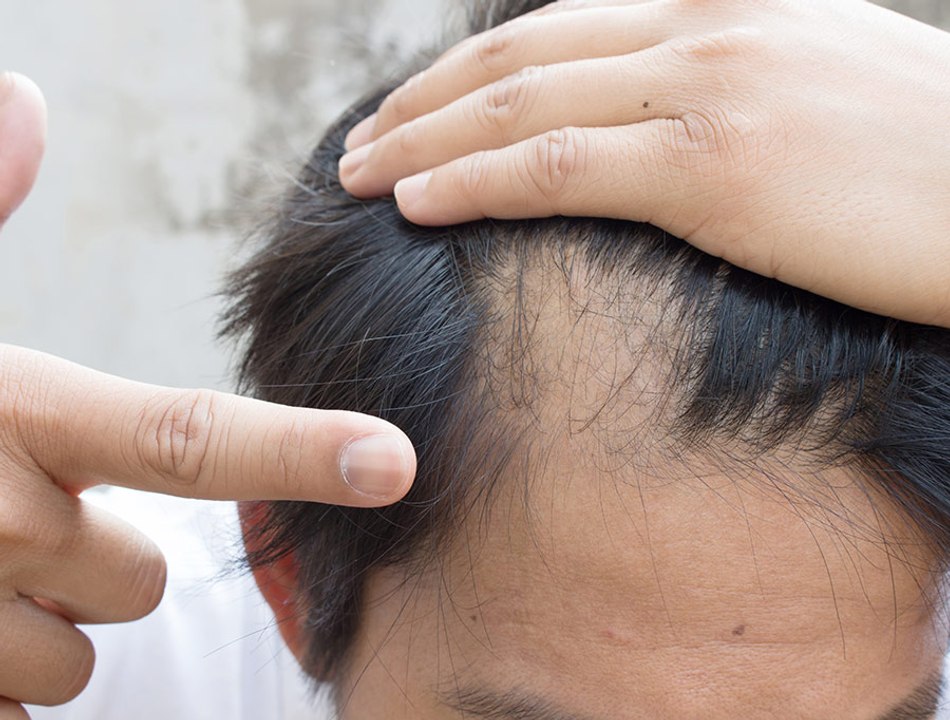 Castor Oil and Olive Oil For Hair Growth