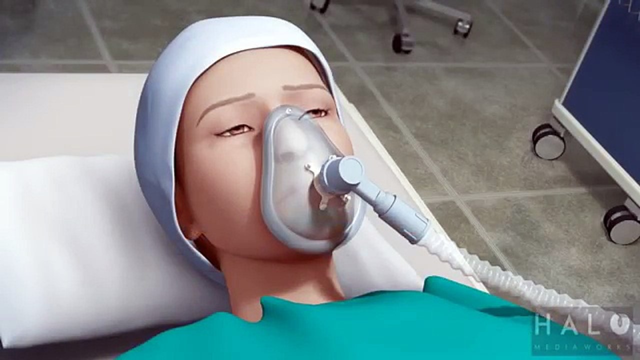 Burun Törpüleme Ameliyatı Nasıl Yapılır?